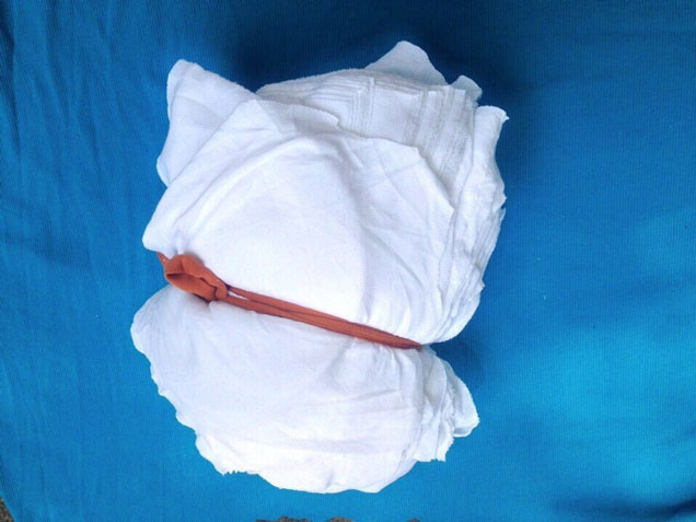 Vải Lau Trắng (Loại 1 Cục=5Kg, Phân Cục)